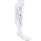 Kendall SCD Express Sleeve, Knee Length, X-Large, 30-45mmHg
